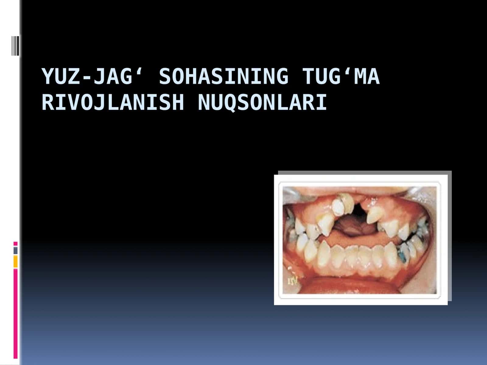 YUZ-JAG‘ SOHASINING TUG‘MA  NUQSONLARI xirurgiyasi 1