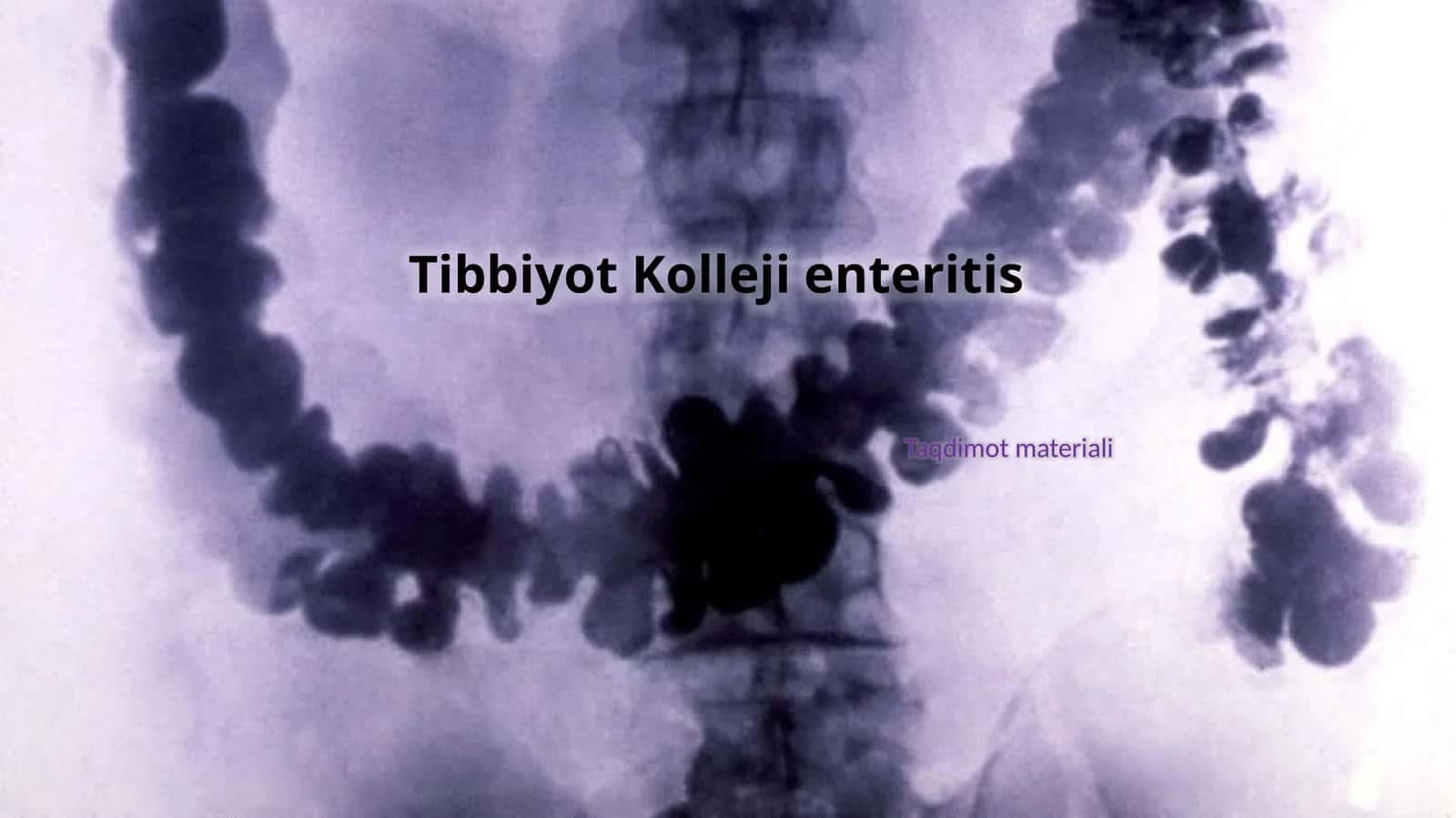 Enterit ingichka ichak yallig'lanishi (1-variant) 1