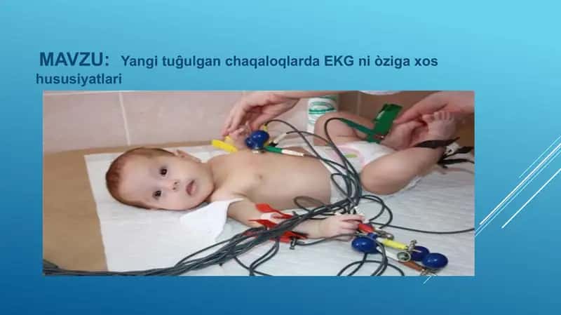 Elektrokardiogramma (EKG) 1