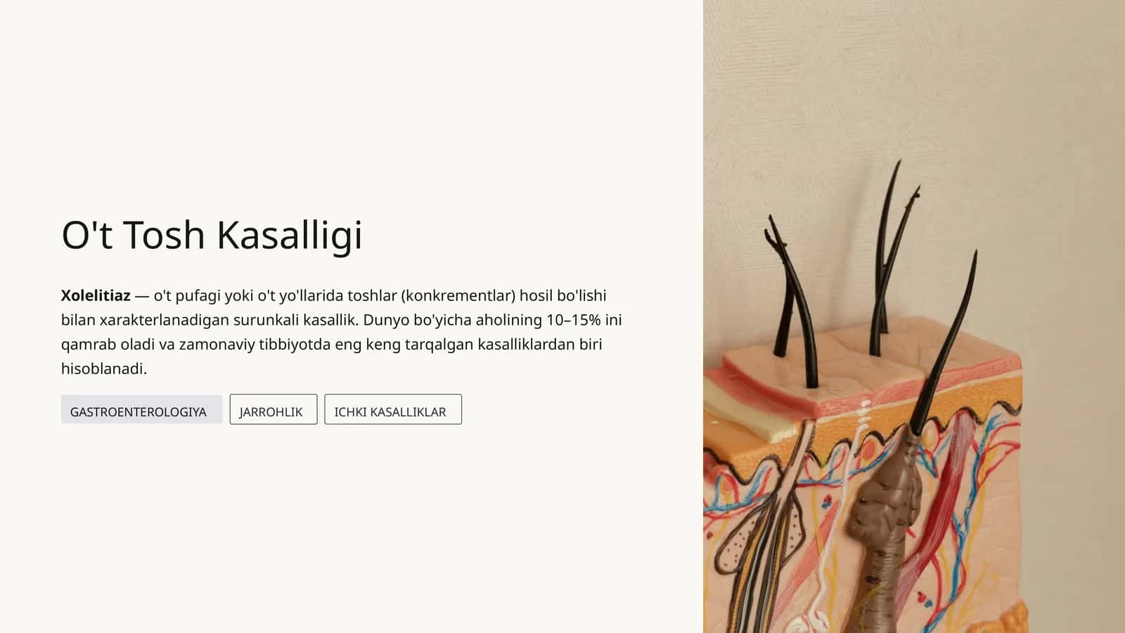 O't Tosh Kasalligi 1
