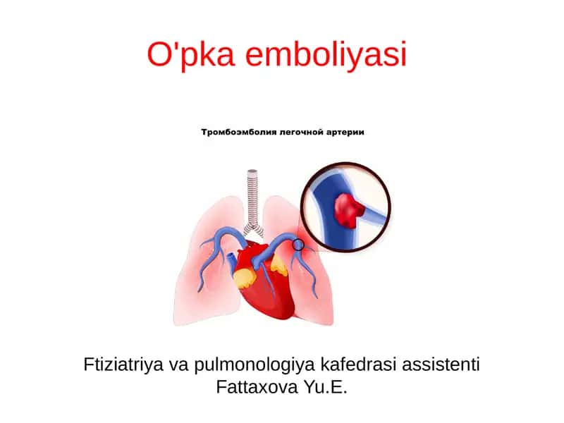 O'pka emboliyasi 1