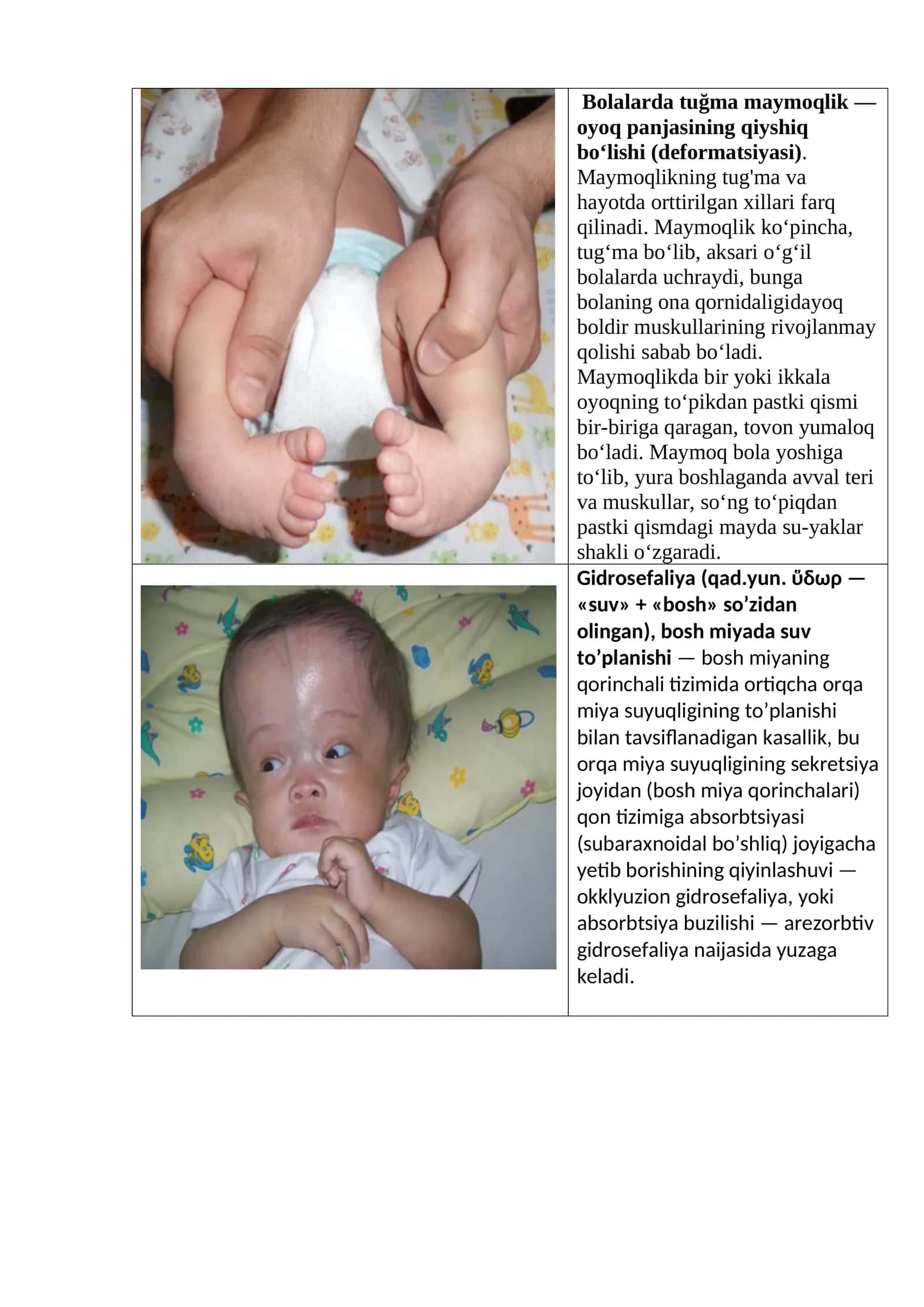 Bolalarda tuğma maymoqlik 1