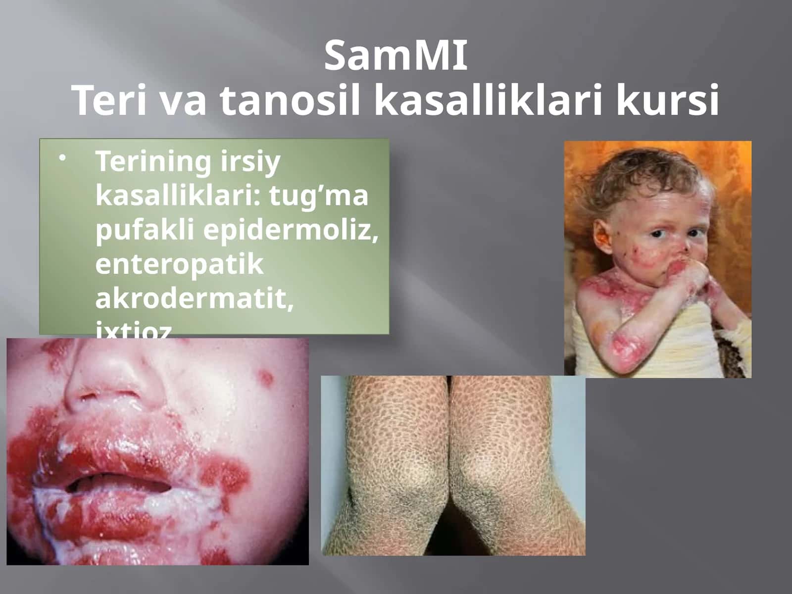 SamMITeri va tanosil kasalliklari kursi 1