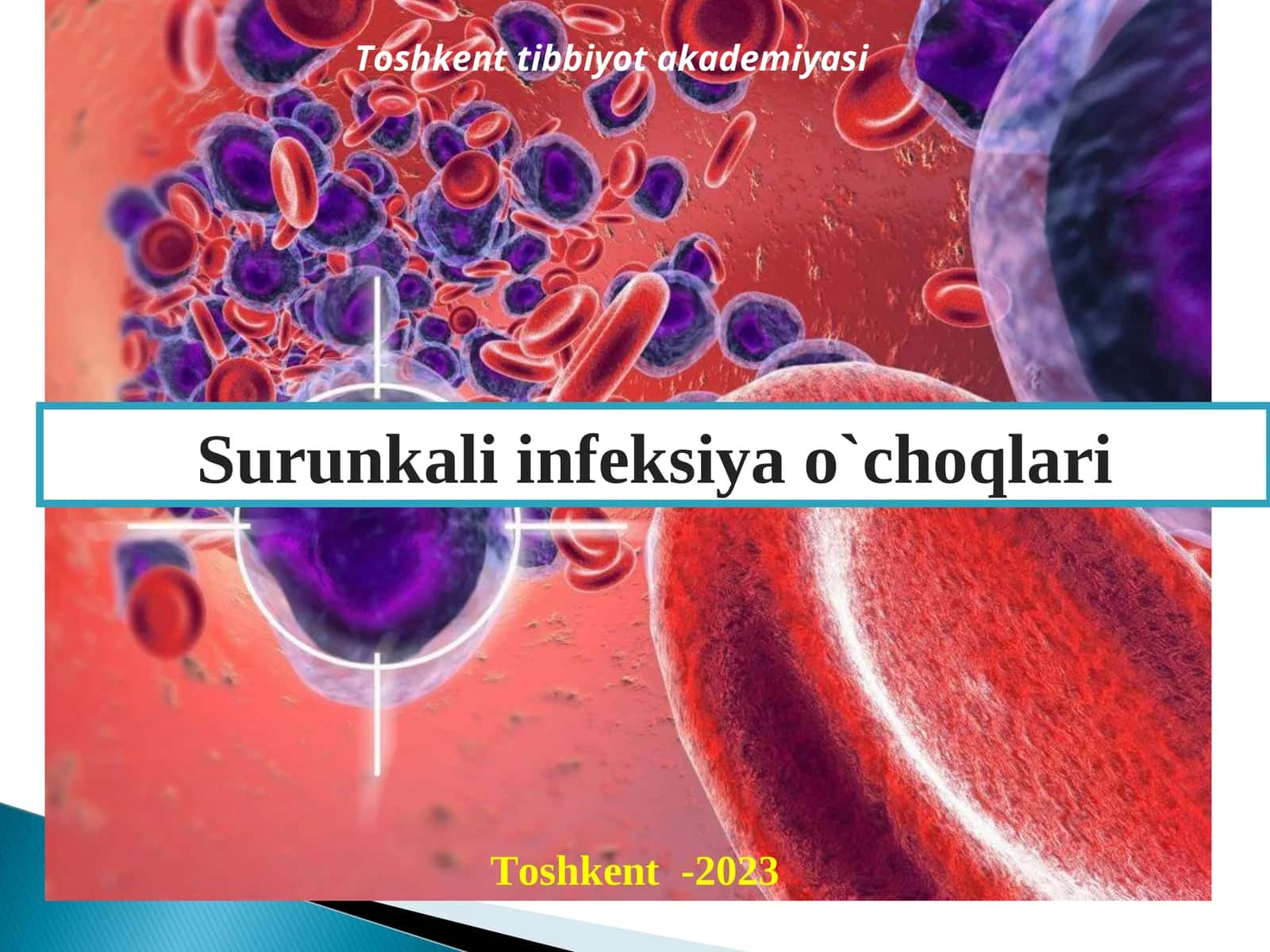 Surunkali infeksiya o`choqlari 1