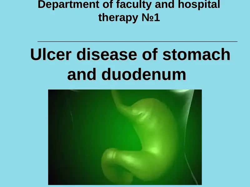 Ulcer disease of stomach and duodenum 1