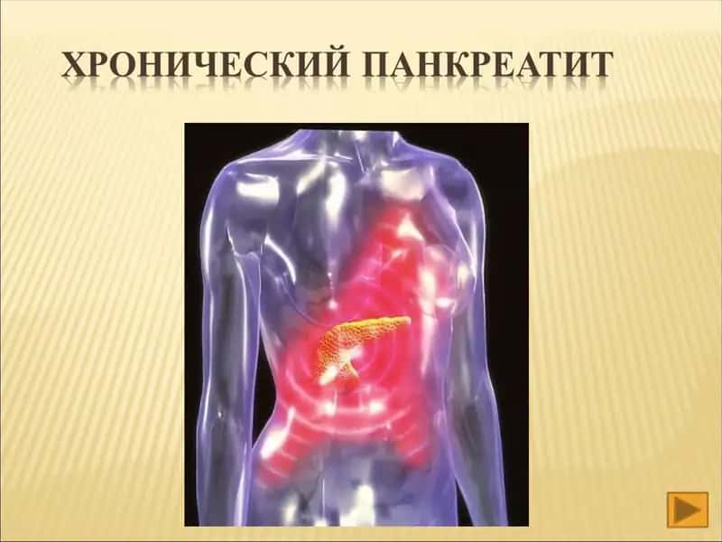 Хронического панкреатит 1