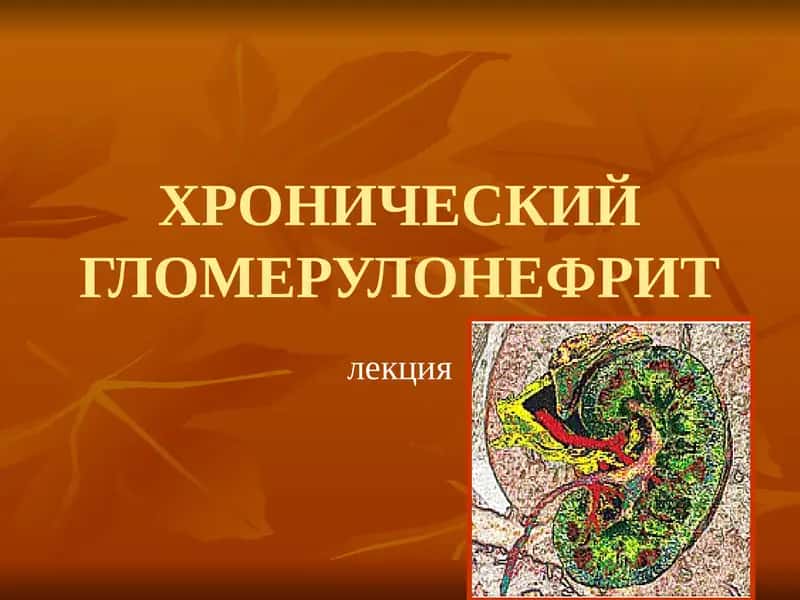 ХРОНИЧЕСКИЙ ГЛОМЕРУЛОНЕФРИТ 1