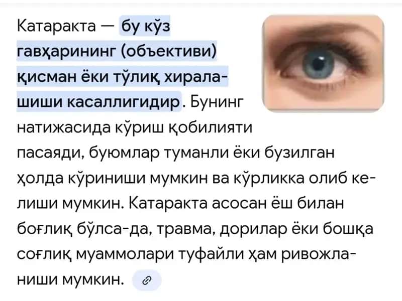 Ko'z kasalliklari. Katarakta. 1