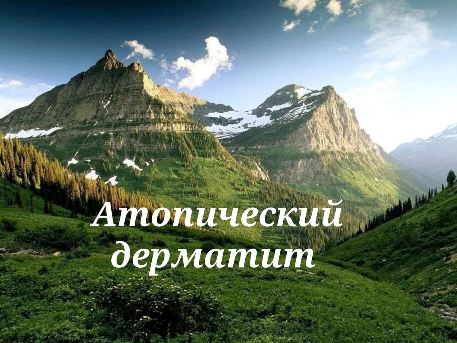 атопик дерматит 1