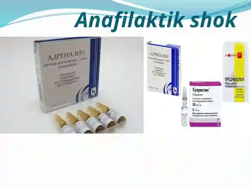 Anafilaktik shok