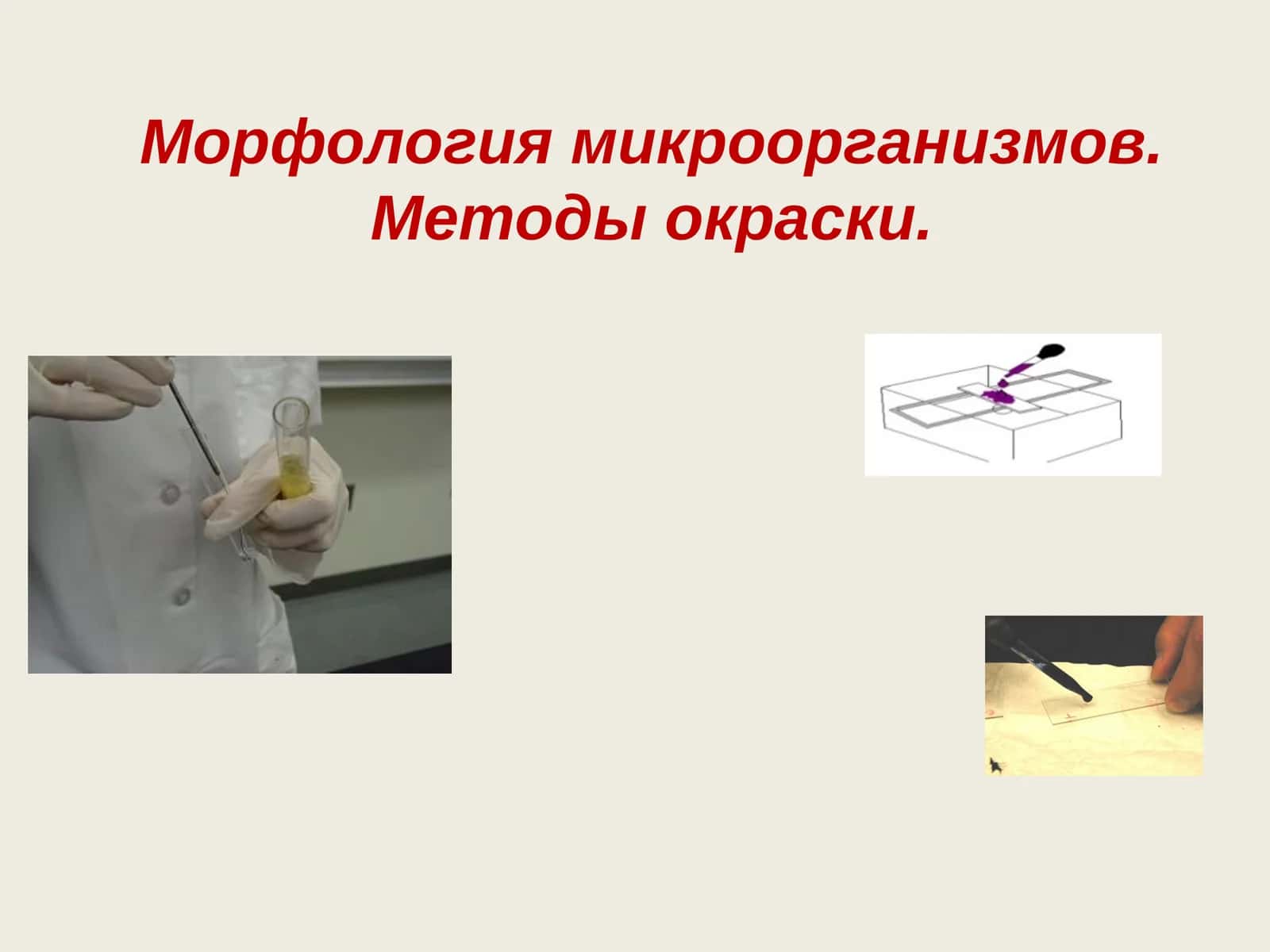 Морфология микроорганизмов.Методы окраски 1