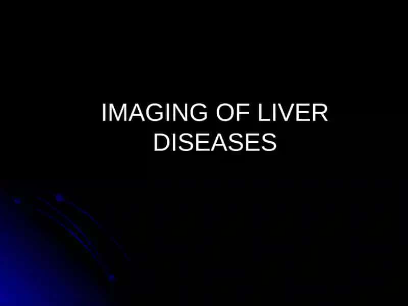IMAGING OF LIVER DISEASES