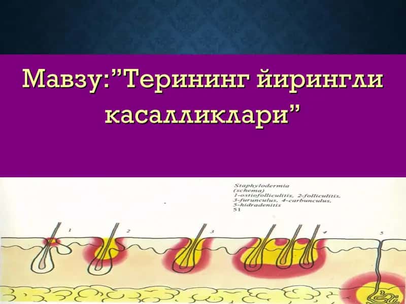 Терининг йирингли касалликлари 1