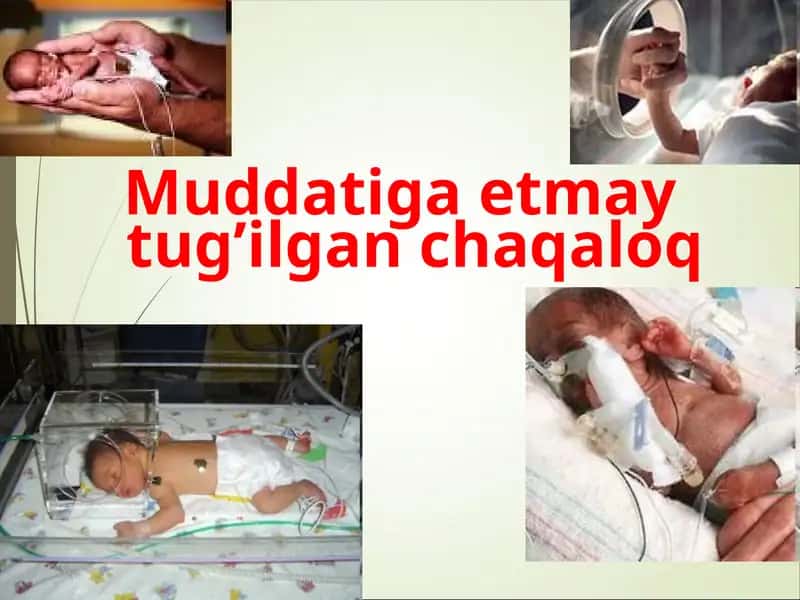 Muddatiga etmay tug’ilgan chaqaloq 1