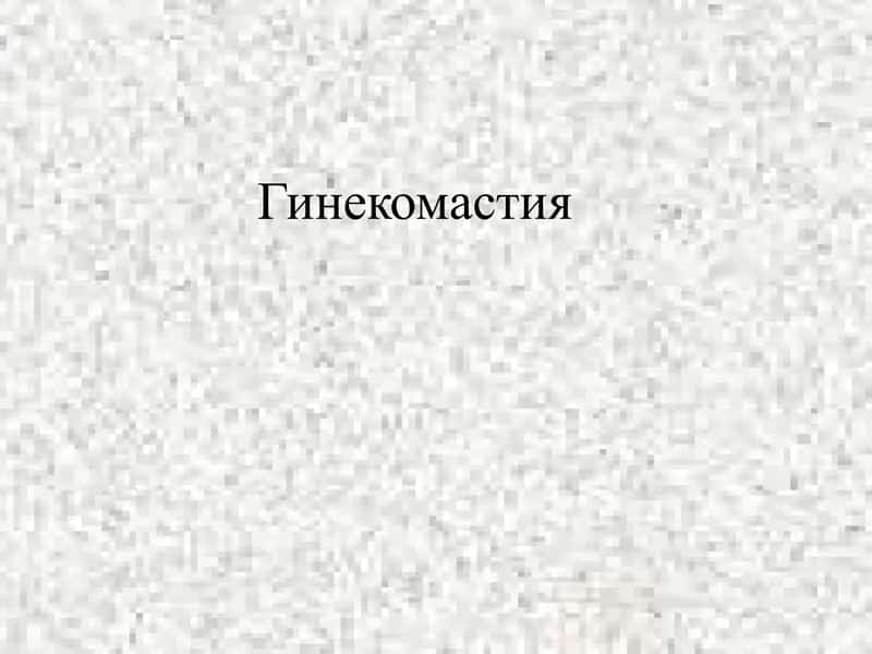 Гинекомастия 1