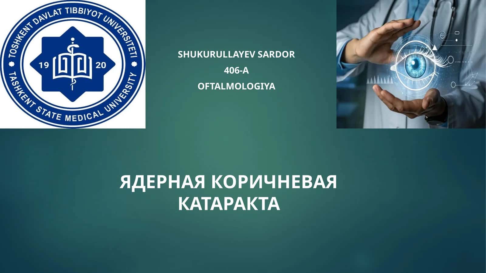 Ядроли катаракта 1