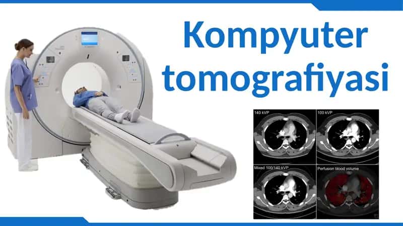 Kompyuter tomografiyasi 1
