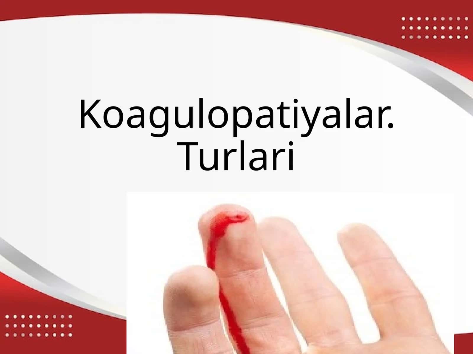 Koagulopatiyalar. Turlari 1