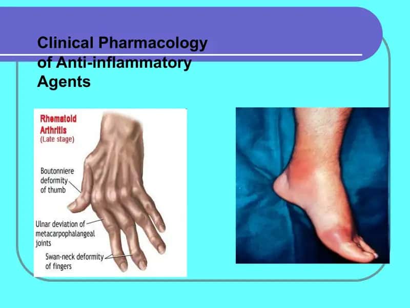 Clinical Pharmacology of Anti-inflammatory Agents 1