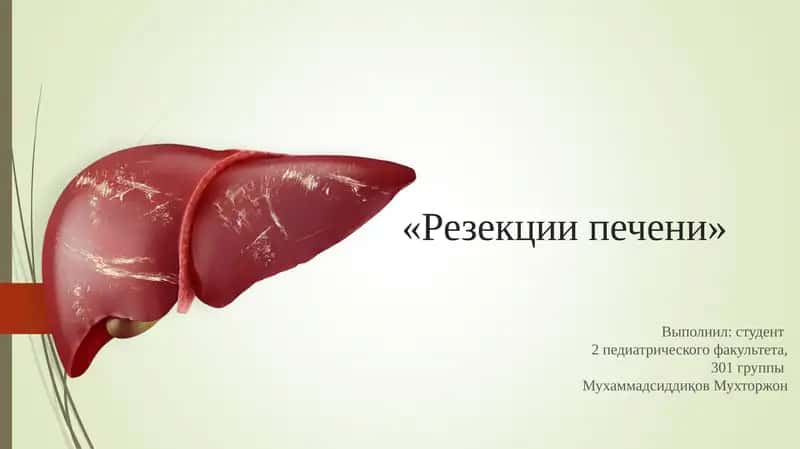 Резекции печени 1