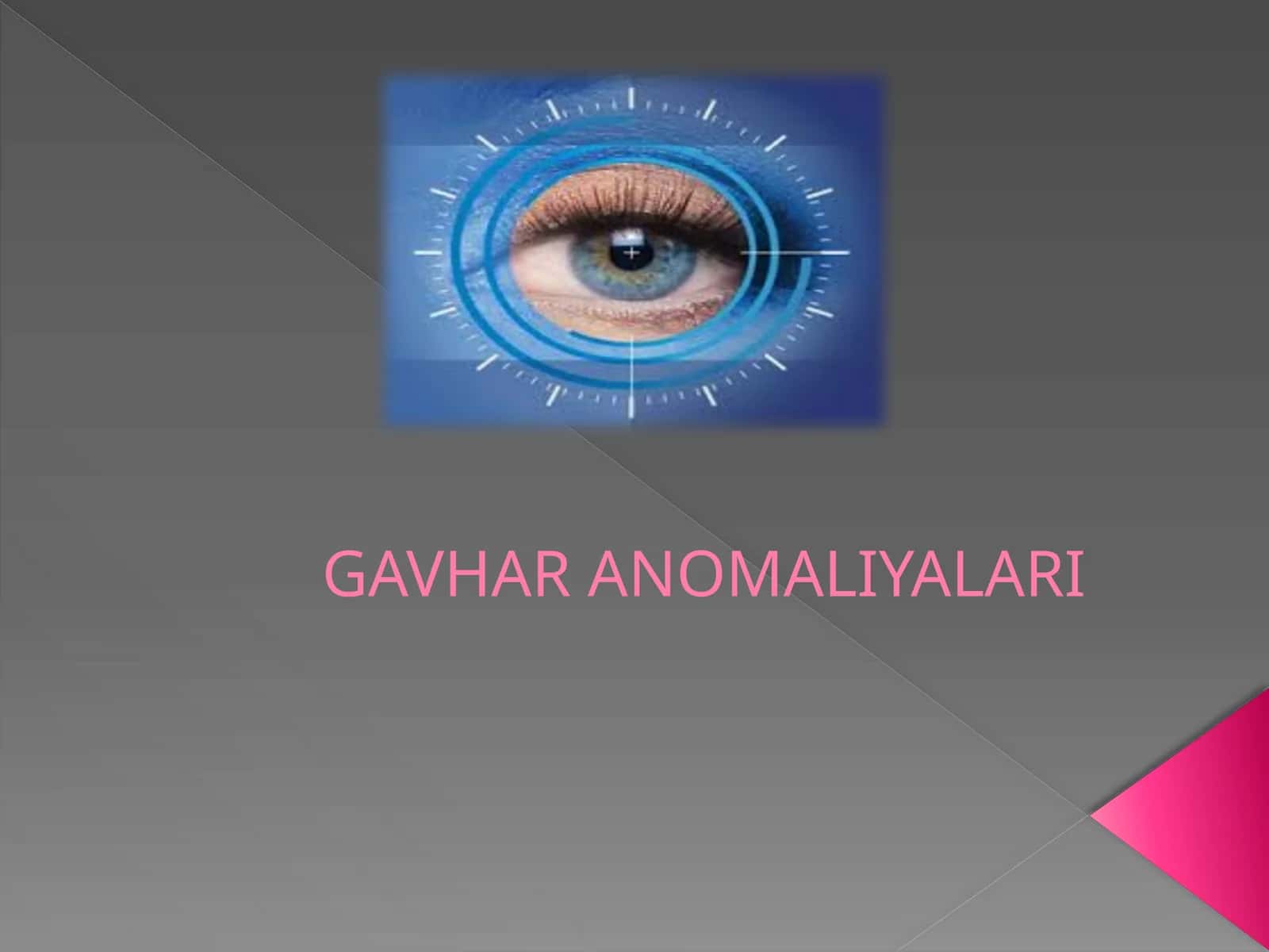 GAVHAR ANOMALIYALARI 1