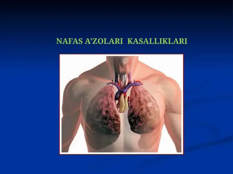 NAFAS A'ZOLARI KASALLIKLARI 1