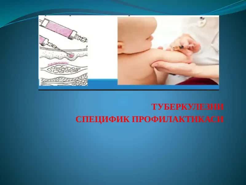 Туберкулезни Специфик Профилактикаси 1