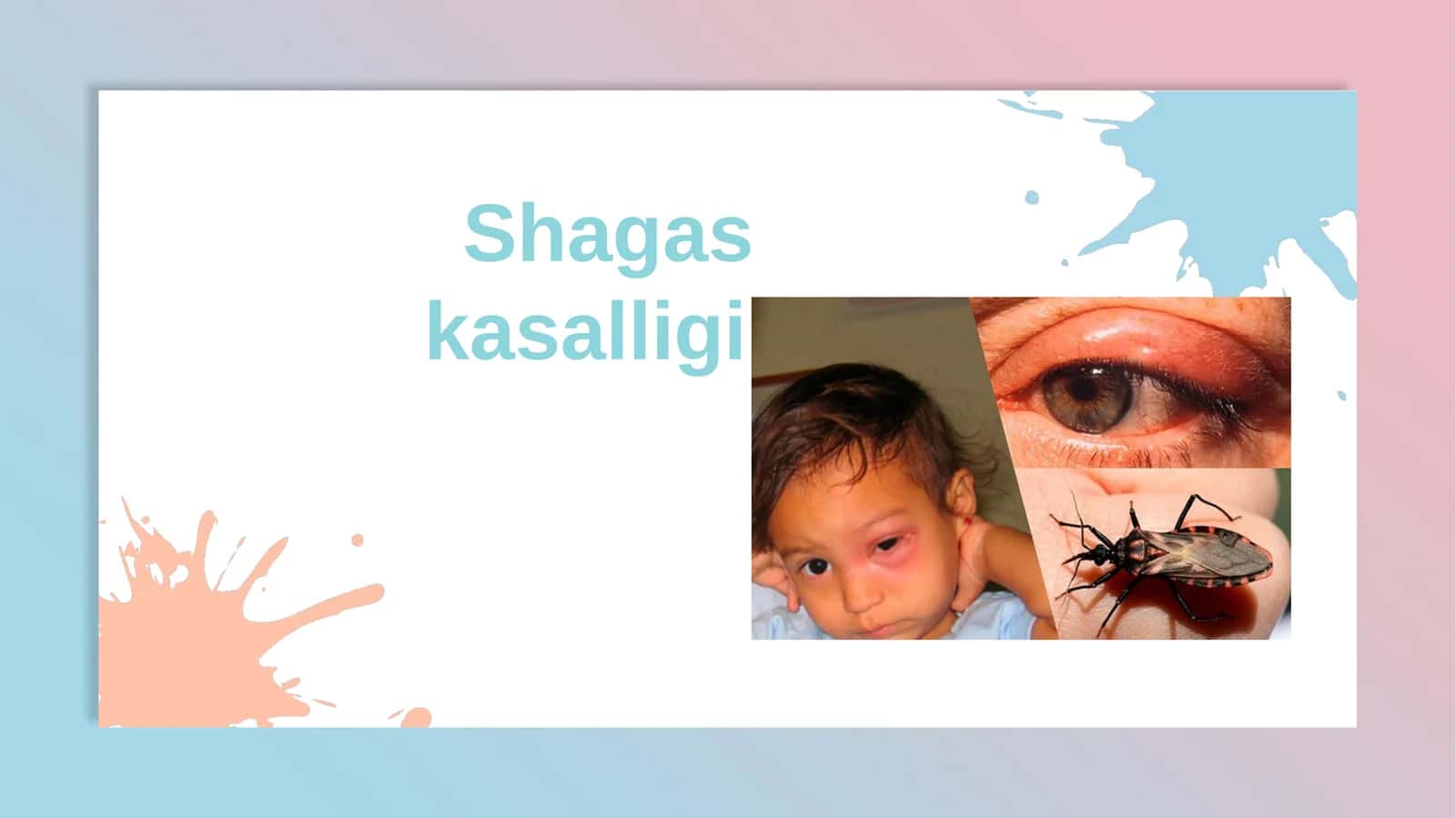 Chagas kasalligi - Trypanosoma cruzi (T. cruzi) parazitidan kelib chiqqan yuqumli kasallik 1