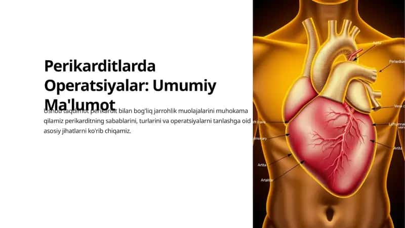 Perikarditlarda Operatsiyalar: Umumiy Ma'lumot 1
