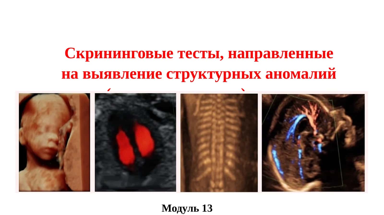 Скрининговые тесты, направленные на выявление структурных аномалий (пороков развития) плода 1