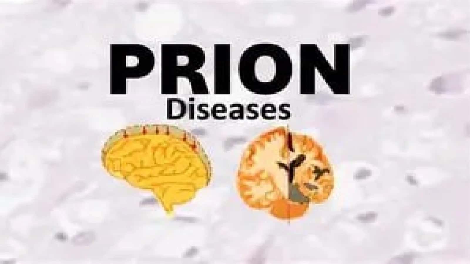 Prion Kasalliklari 1