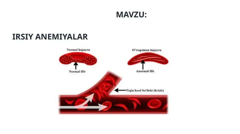 IRSIY ANEMIYALAR 1