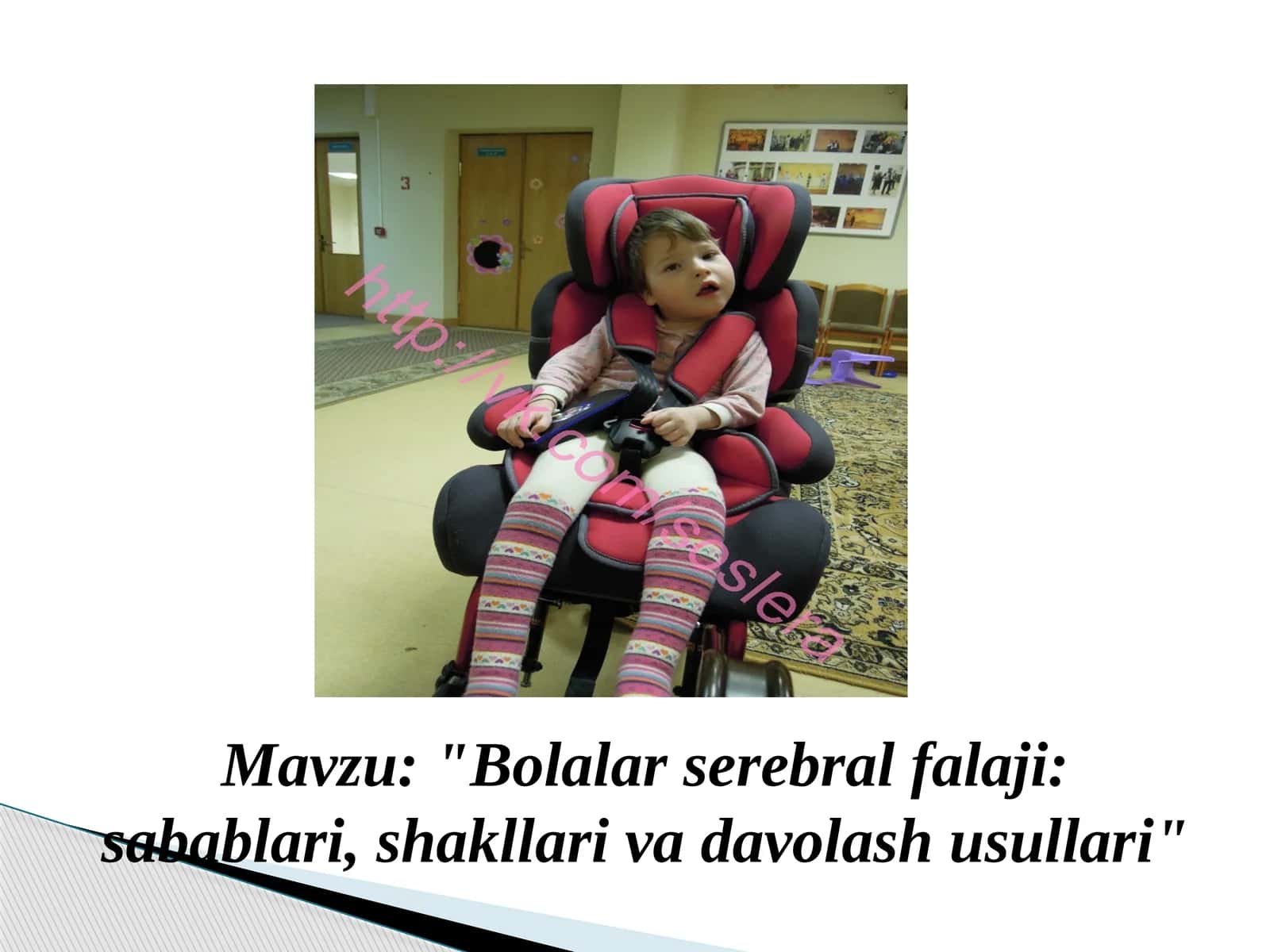 Bolalar serebral falaji (BSF) sabablari va davolash 1