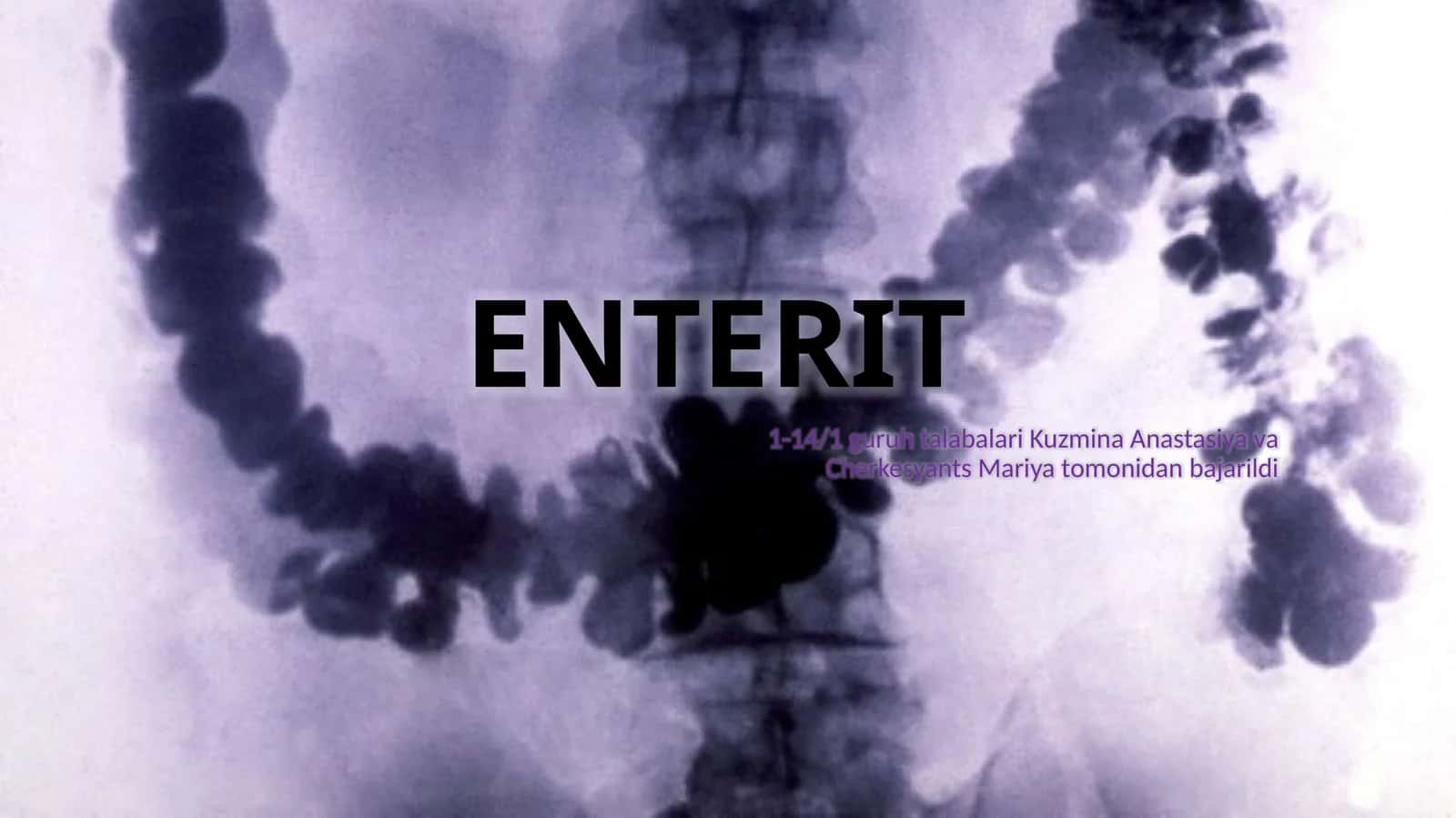 Enterit ingichka ichak yallig'lanishi (1-variant) 1