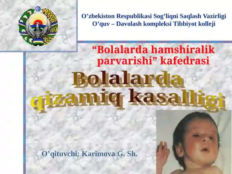 Bolalarda qizamiq kasalligi