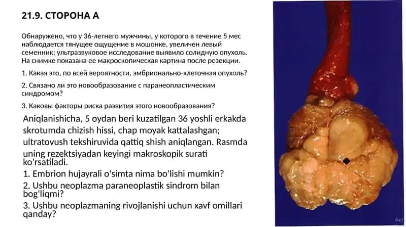 Эмбрионально-клеточная опухоль 1