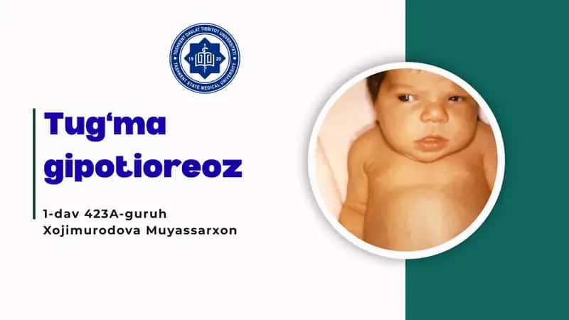 Tug‘ma gipotioreoz 1