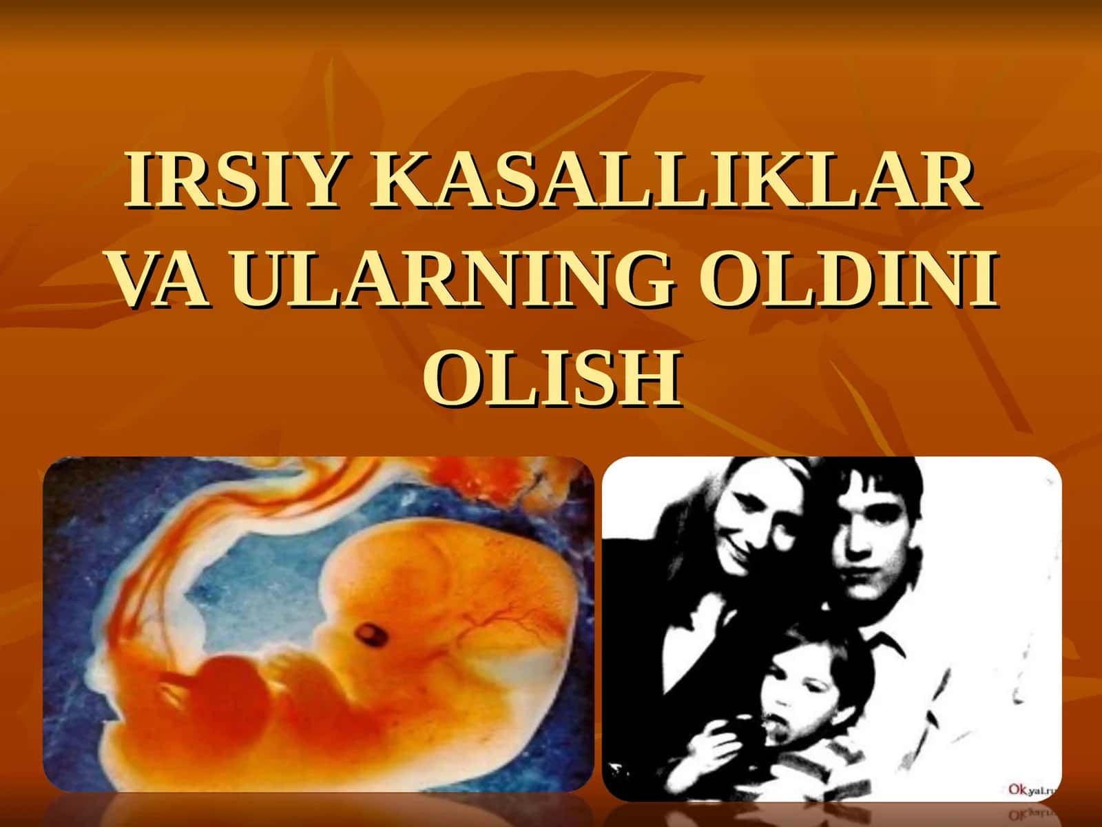 IRSY KASALLIKLAR VA ULARNING OLDINI OLISH 1