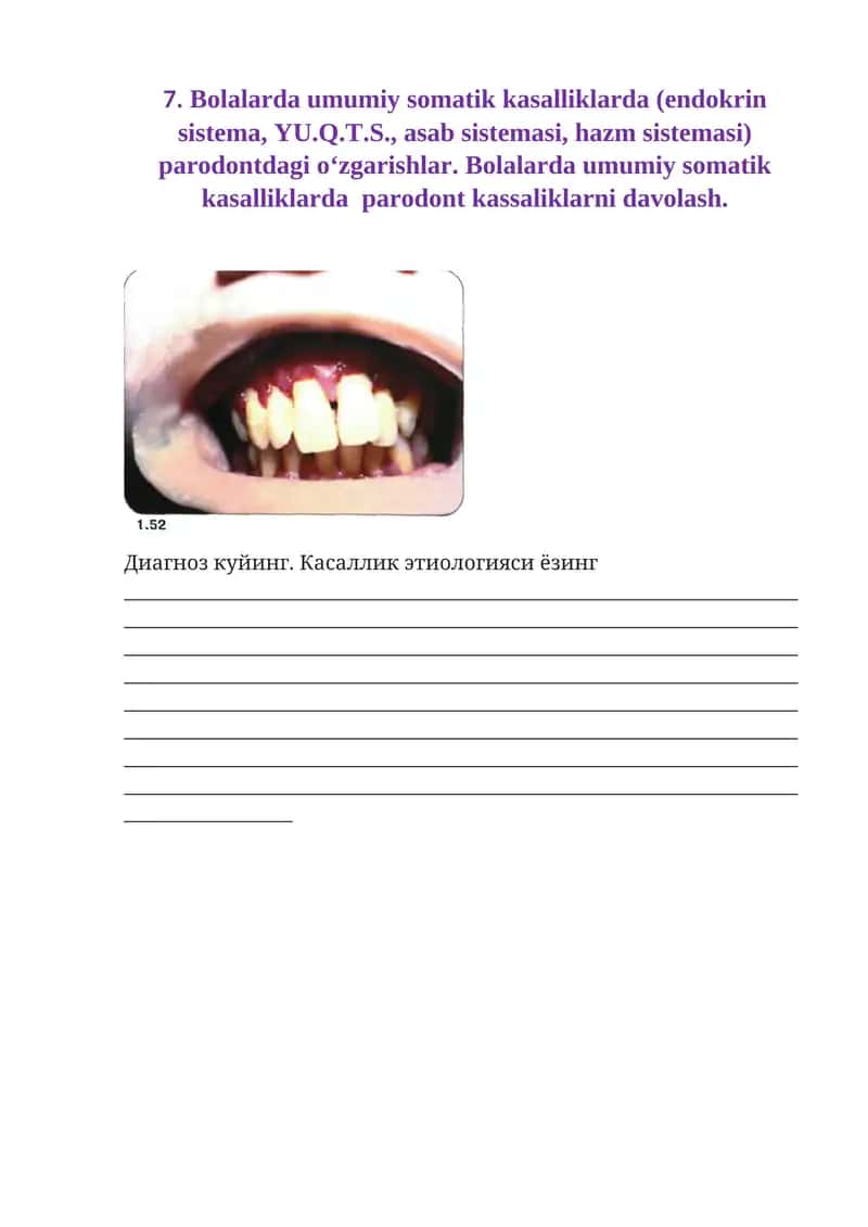 Bolalarda umumiy somatik kasalliklarda (endokrin sistema, YU.Q.T.S., asab sistemasi, hazm sistemasi) parodontdagi o‘zgarishlar 1