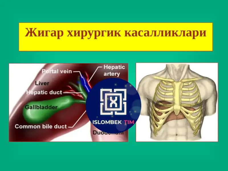 Жигар хирургик касалликлари 1