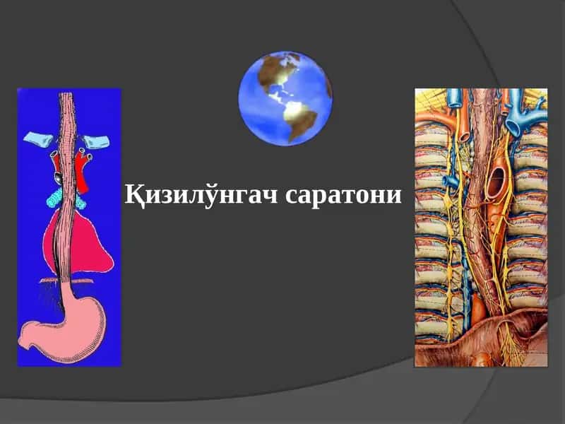 Қизилўнгач саратони 1