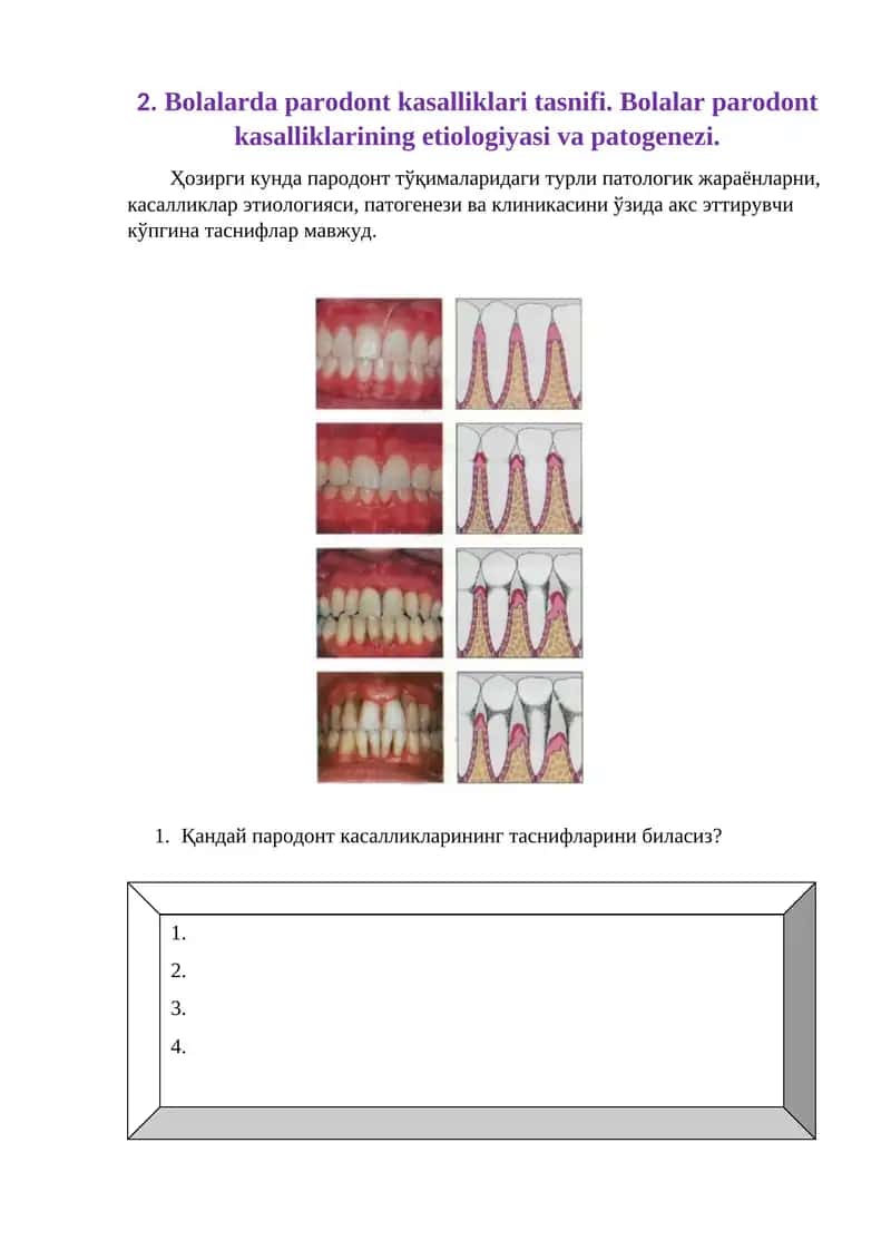 Bolalarda parodont kasalliklari tasnifi. Bolalar parodont kasalliklarining etiologiyasi va patogenezi 1