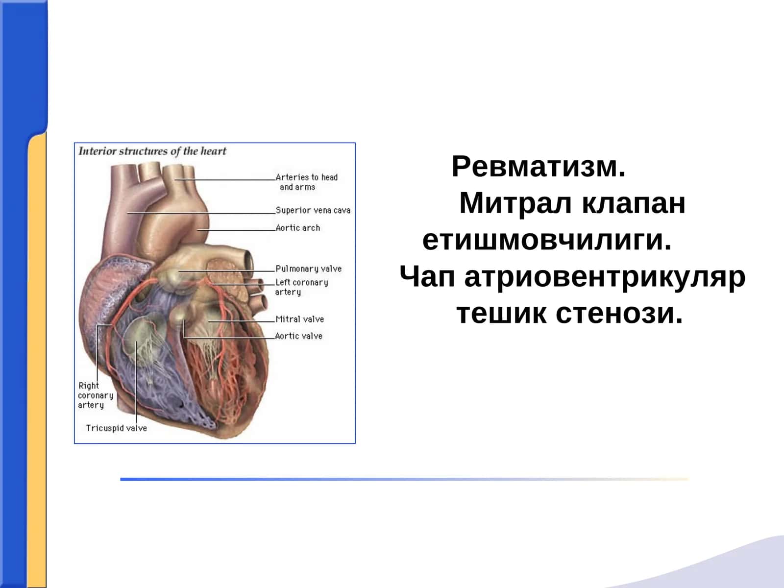 Revmatizm mitral klapan yetishmovchiligi chap atrioventrikulyar teshik stenozi 1
