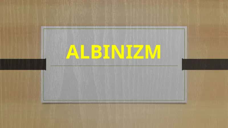 Albinizm 1