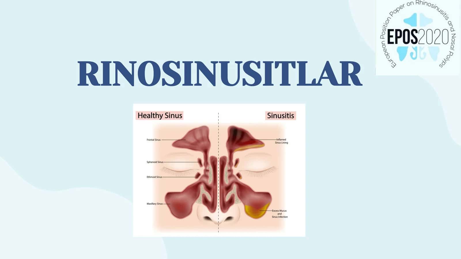 RINOSINUSITLAR 1