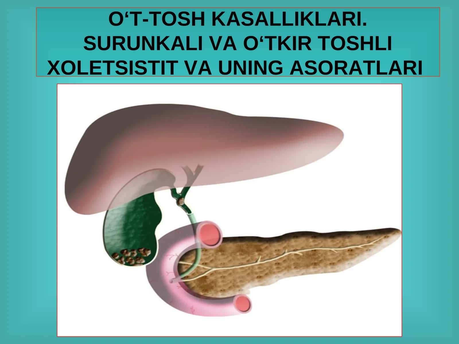 O‘T-TOSH KASALLIKLARI.SURUNKALI VA O‘TKIR TOSHLI XOLETSISTIT VA UNING ASORATLARI 1