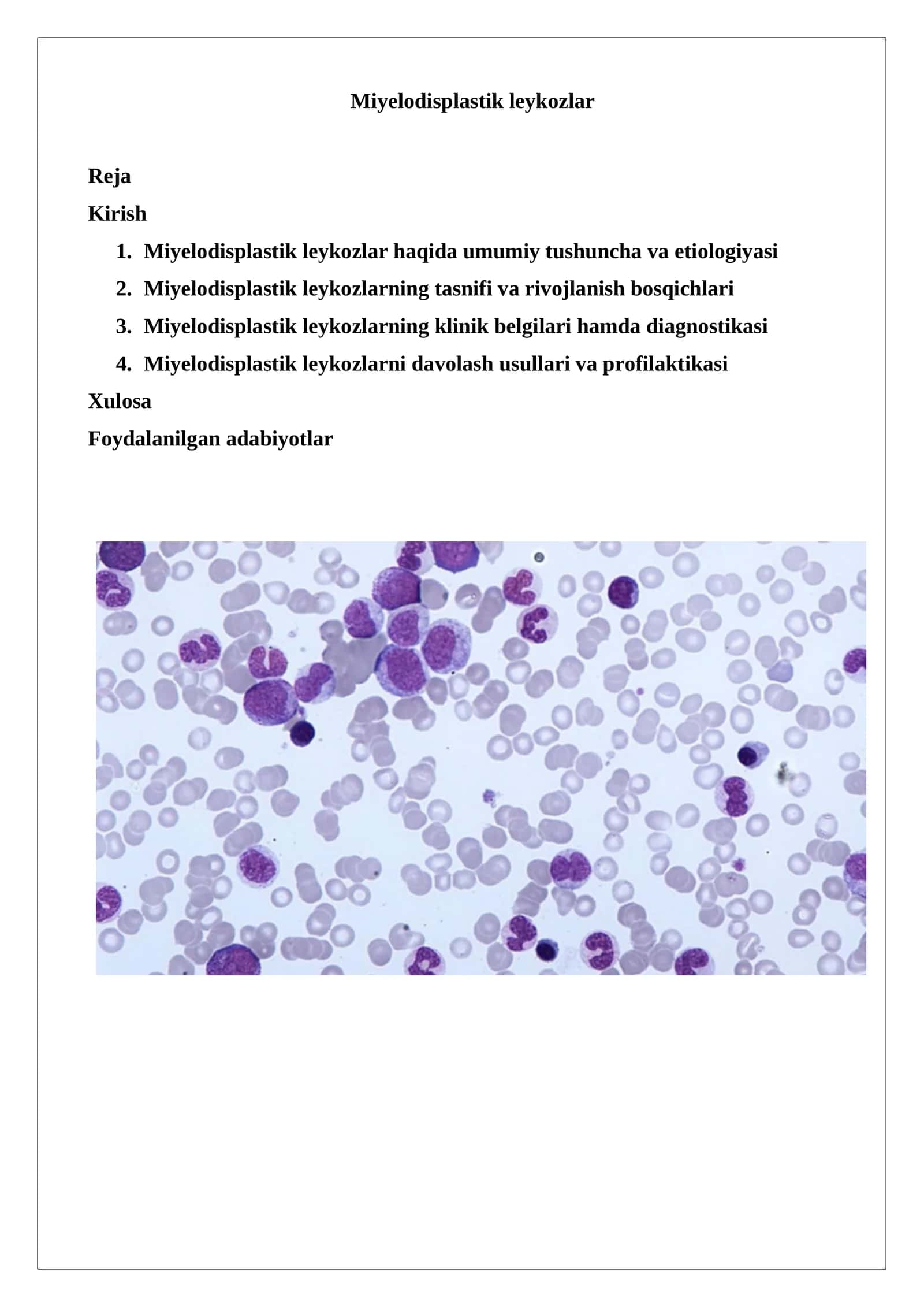 Miyelodisplastik leykozlar 1
