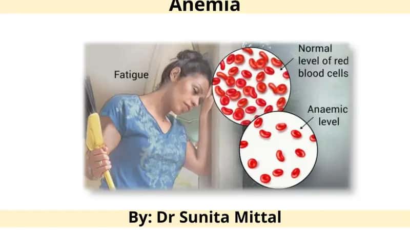 Anemia 1