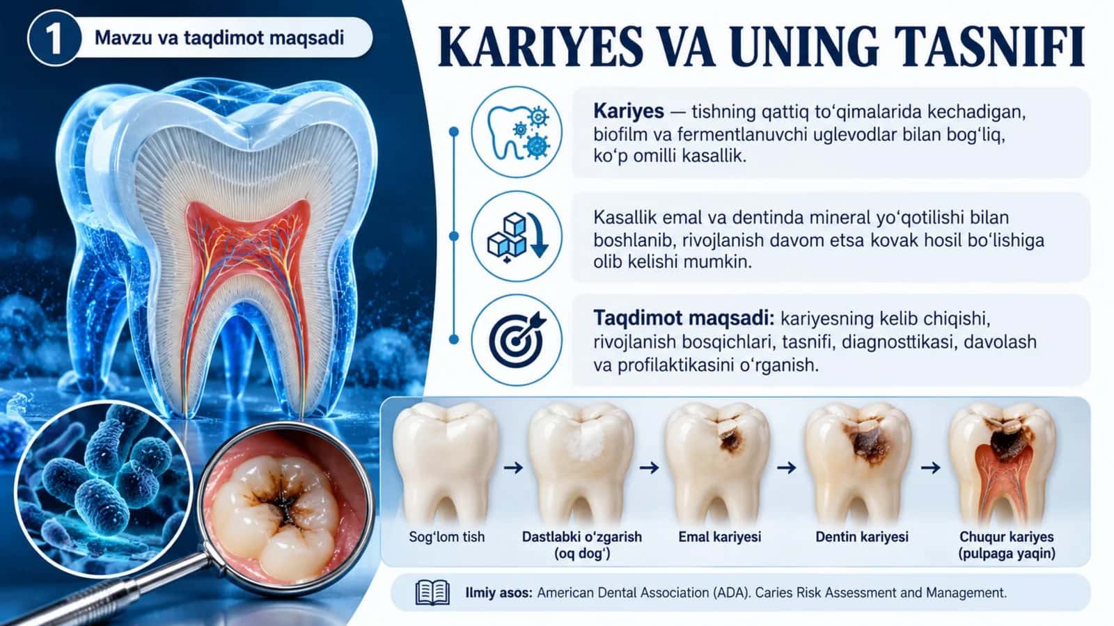 Kariyes va uning tasnifi — Professional tibbiy taqdimot 1