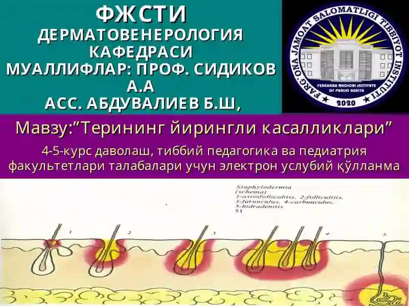 Терининг йирингли касалликлари